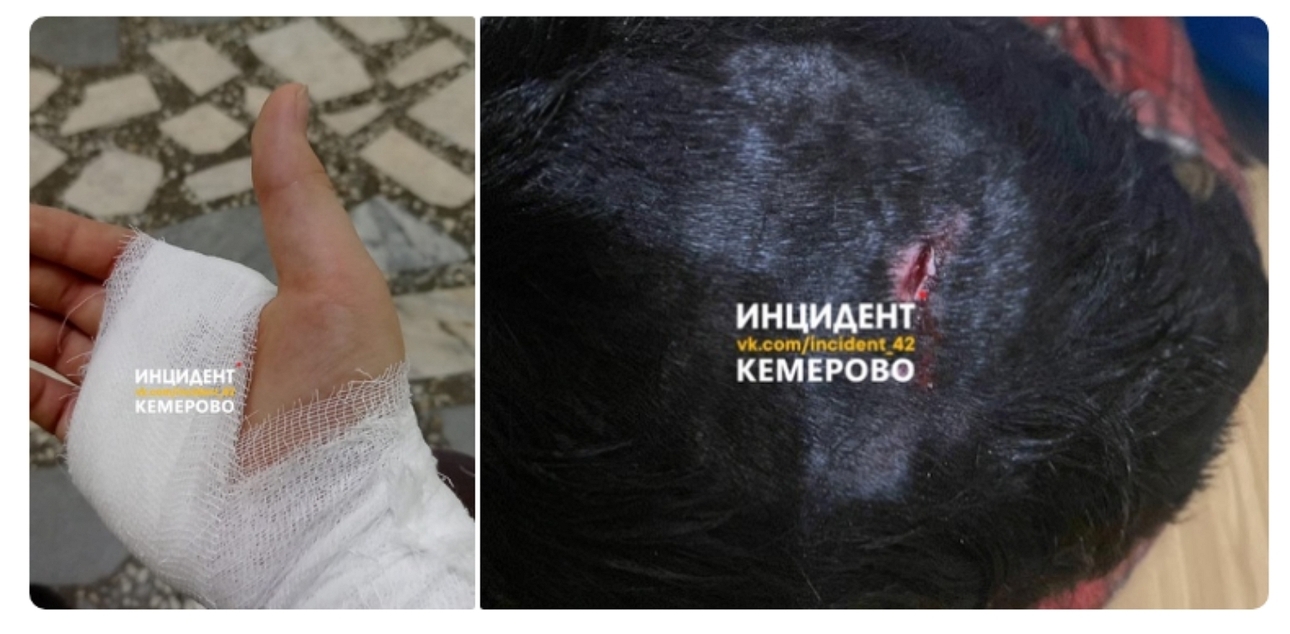Изображение Кемеровчанин и его питомец после атаки бесхозного гиганта